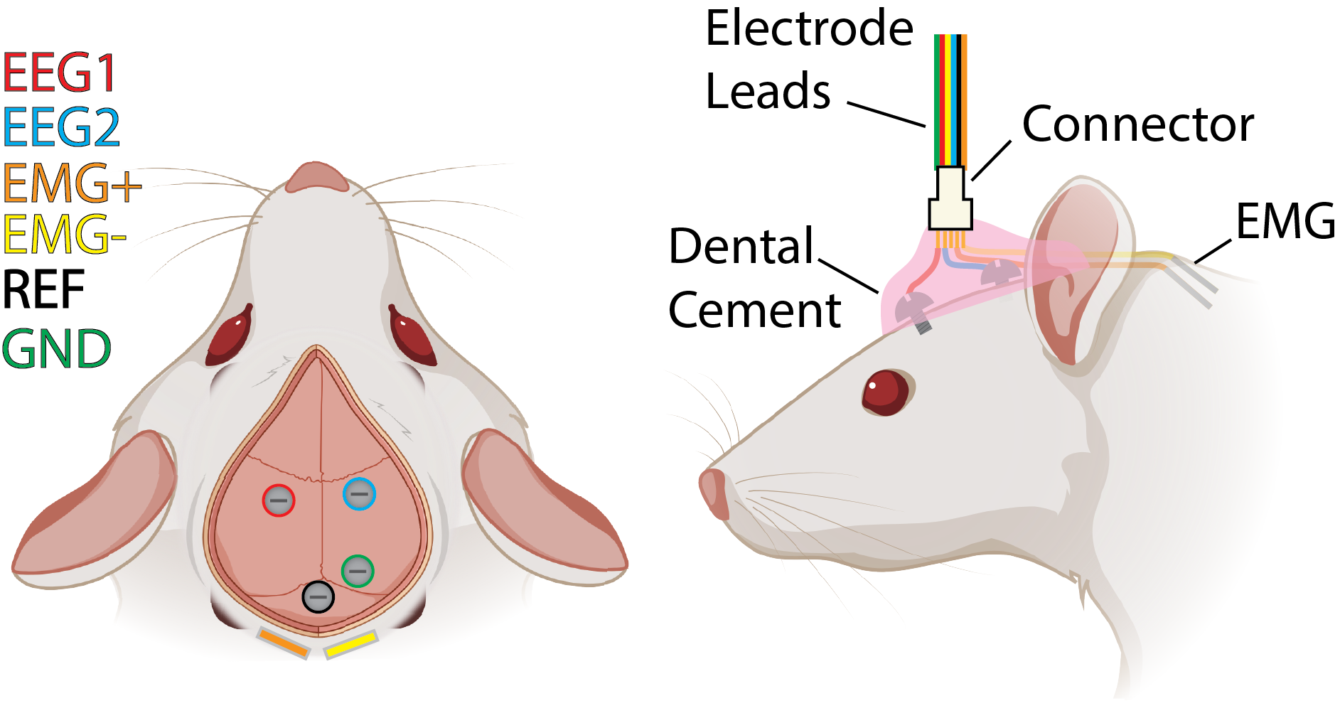 Surgical Example